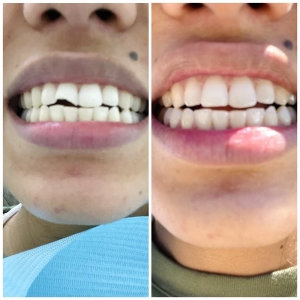 Photo of Compass Dental Arts - Pacific Bay Family, Cosmetic And General Dentistry