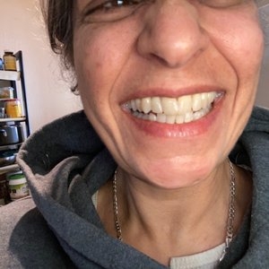 Photo of Stephen Ostwald, DDS Restoring And Enhancing The Natural Beauty