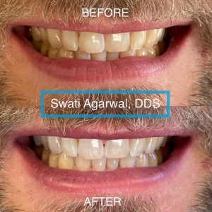 Photo of Swati Agarwal, DDS Team