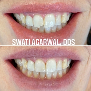 Photo of Swati Agarwal, DDS Team
