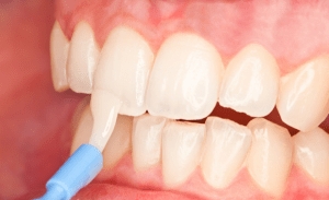 Photo of Sunrise Dental of Shoreline Dental Care Provider
