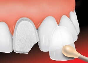 Photo of Sunrise Dental of Shoreline Dental Care Provider