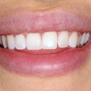 Photo of Downtown Dentist SF