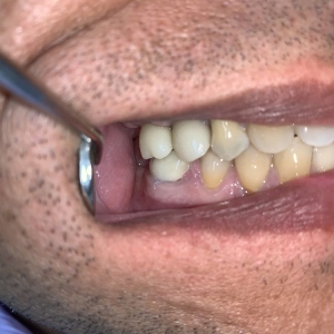 Photo of Cesar Hurtado, DDS Over 20 Years Of Experience In Endodontics