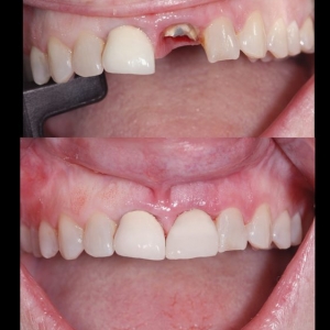Photo of Implants Pro Center