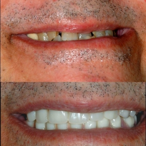 Photo of Implants Pro Center