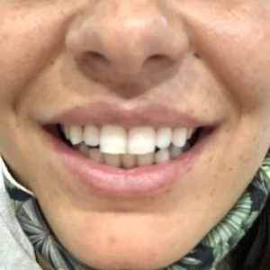 Photo of Fillmore Dental Spa Dental Treatment
