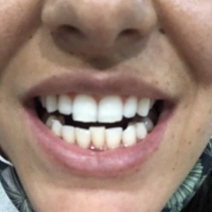 Photo of Fillmore Dental Spa Dental Treatment