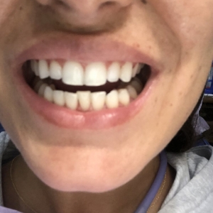Photo of Fillmore Dental Spa Dental Treatment