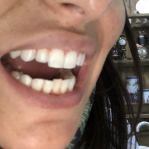 Photo of Fillmore Dental Spa Dental Treatment
