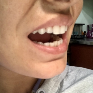 Photo of Fillmore Dental Spa Dental Treatment