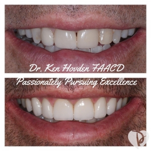 Photo of Kenneth Hovden, DDS Top Quality Dental Services