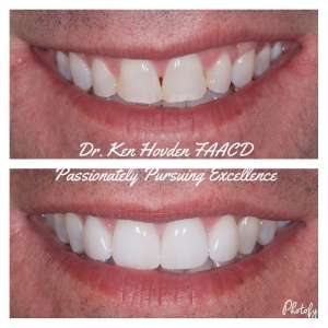 Photo of Kenneth Hovden, DDS Top Quality Dental Services