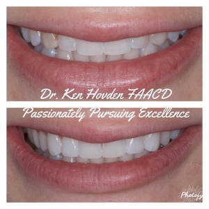 Photo of Kenneth Hovden, DDS Top Quality Dental Services