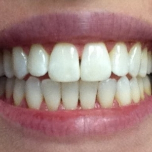 Photo of Kristina Zoulas, DDS - Westborough Dental Care