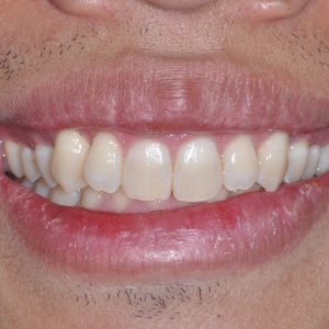 Photo of Carrie Berkovich, DDS MS Streamline Our Patients' Treatment