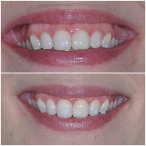 Photo of Carrie Berkovich, DDS MS Streamline Our Patients' Treatment