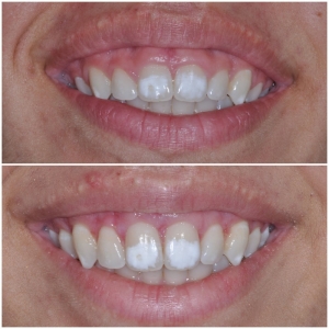 Photo of Carrie Berkovich, DDS MS Streamline Our Patients' Treatment