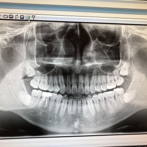 Photo of Dental Implant and Oral Surgery Center