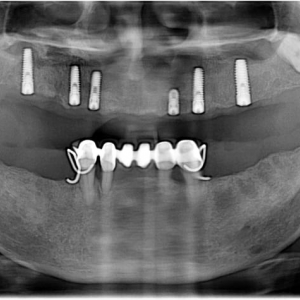 Photo of Dental Implant and Oral Surgery Center