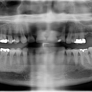 Photo of Dental Implant and Oral Surgery Center