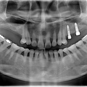 Photo of Dental Implant and Oral Surgery Center