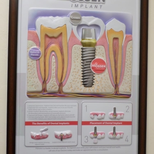 Photo of William R Hummer, DDS Painless, Comprehensive Dental Care