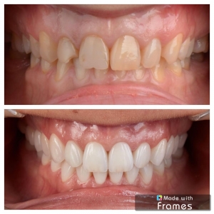 Photo of Albina Batchaeva, DDS - Dental Arts Clinic