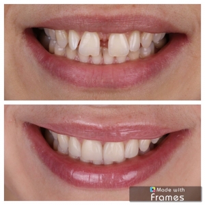 Photo of Albina Batchaeva, DDS - Dental Arts Clinic