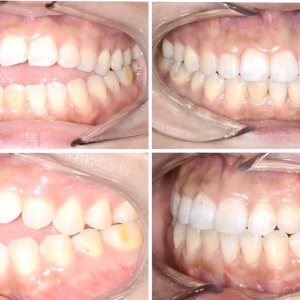Photo of Amanda Cheng - Days to Smile Orthodontics