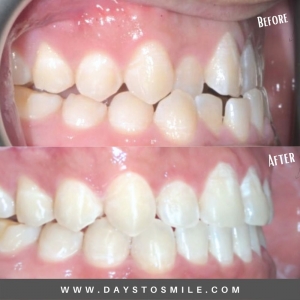 Photo of Amanda Cheng - Days to Smile Orthodontics