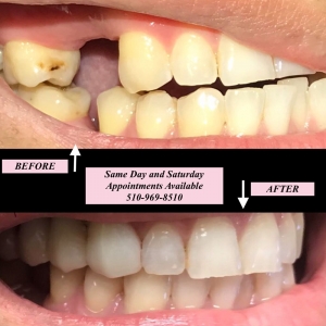 Photo of KB San Leandro Dental Studio: Azita Kabiri, DDS Gentle Dentistry Services