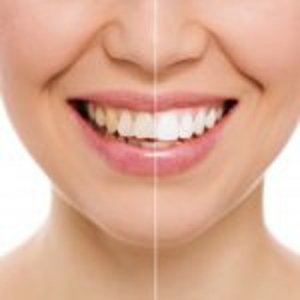 Photo of New Life Dental Center Numerous Dental Services