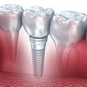 Photo of 34th Street Dental Care providing expert dental services