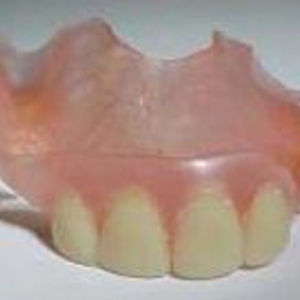 Photo of OMS Center Getting Dental Implants In Lafayette Or Logansport