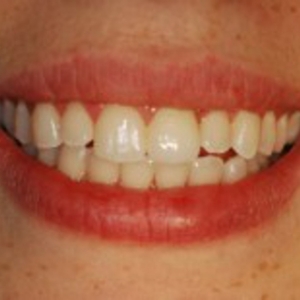 Photo of Marlin Gerald M DMD Providing Dental Implant And Cosmetic Dentistry