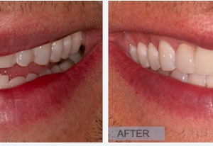 Photo of Chelsea Dental Aesthetics: David Blaustein, DDS
