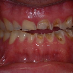 Photo of Doundoulakis James DMD, MS A Trained Specialist In Prosthodontics