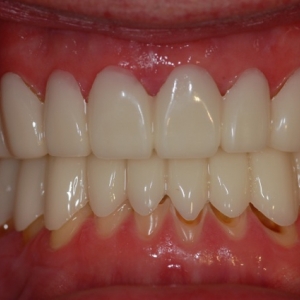 Photo of Doundoulakis James DMD, MS A Trained Specialist In Prosthodontics