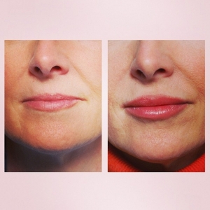 Photo of Dr. Oscar L. Castro, DDS On-site Board Certified Specialists