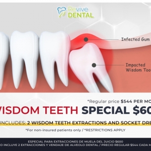 Photo of Revive Dental of Irving Family Cosmetic Emergency Implants
