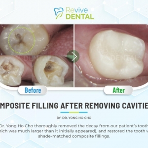 Photo of Revive Dental of Irving Family Cosmetic Emergency Implants
