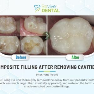 Photo of Revive Dental of Irving Family Cosmetic Emergency Implants
