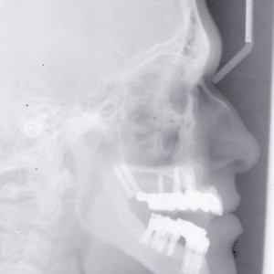Photo of Pi Dental Center Providing Our Dental Patients