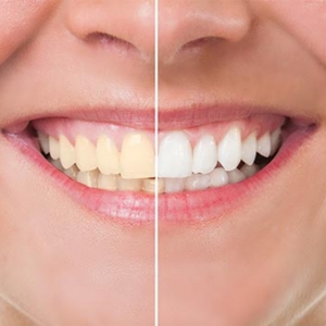 Photo of Parkway Dental of Clinton Strive To Make Every Patient Feel Comfortable