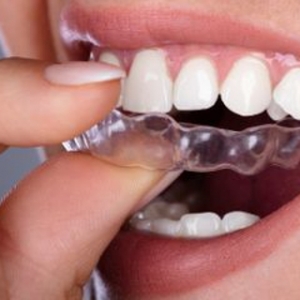 Photo of Lamont Jacobs Orthodontics, Inc. A Healthy, Bright And Straight Smile