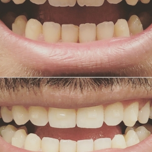 Photo of Endres Gateway Dentistry Compassionate, High Quality Dentistry