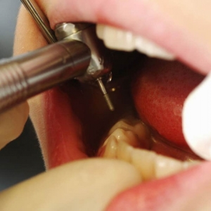 Photo of Best Dentists Clinic Offer Comprehensive Dental Services