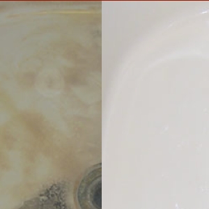 Photo of Crown Resurfacing