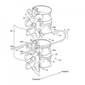 Photo of OC Patent